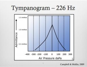 timpanometria